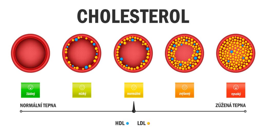 Masticha pro snížení cholesterolu